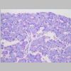 Pancreas SF 12.jpg
